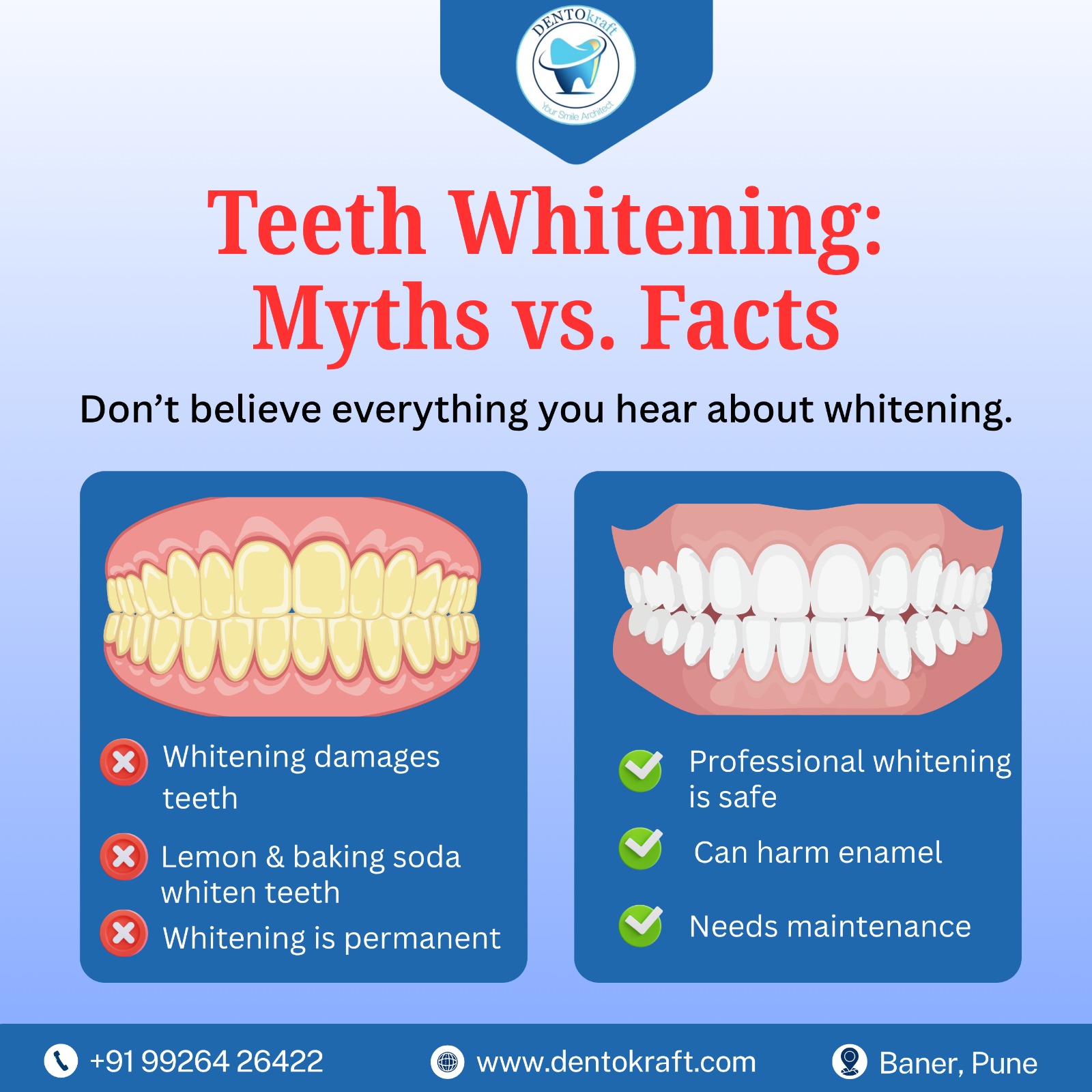  Teeth Whitening: Myths vs. Facts