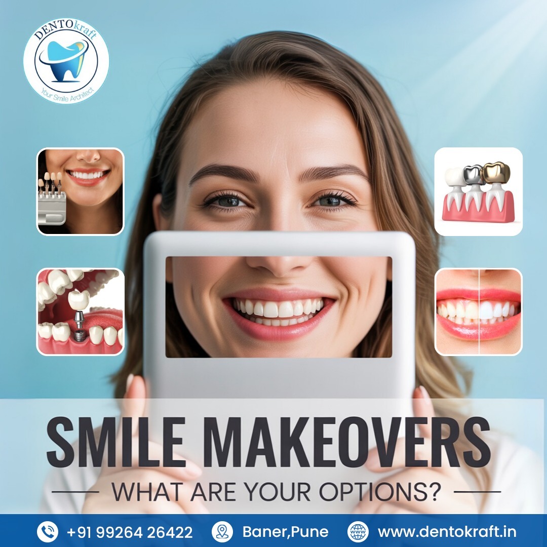 Smile Makeovers: What Are Your Options?